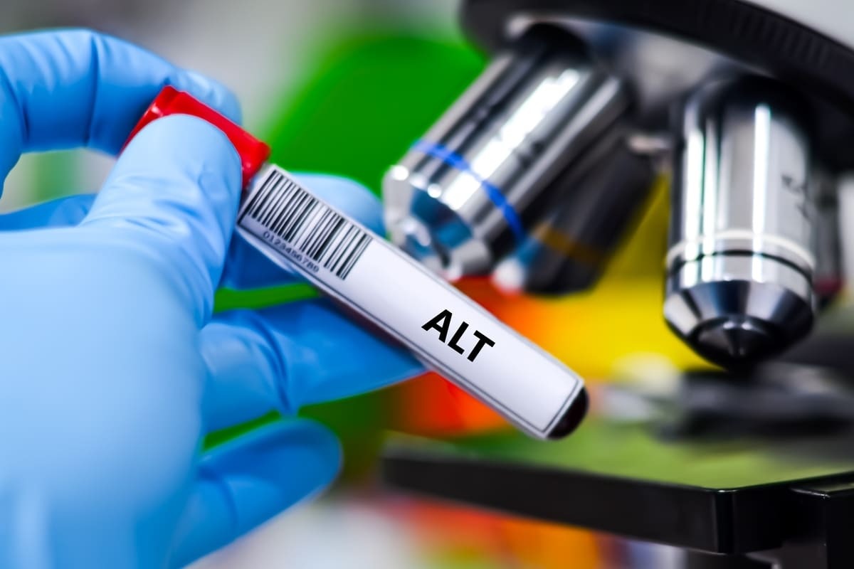 eprubetă cu sânge pentru analiza ALT