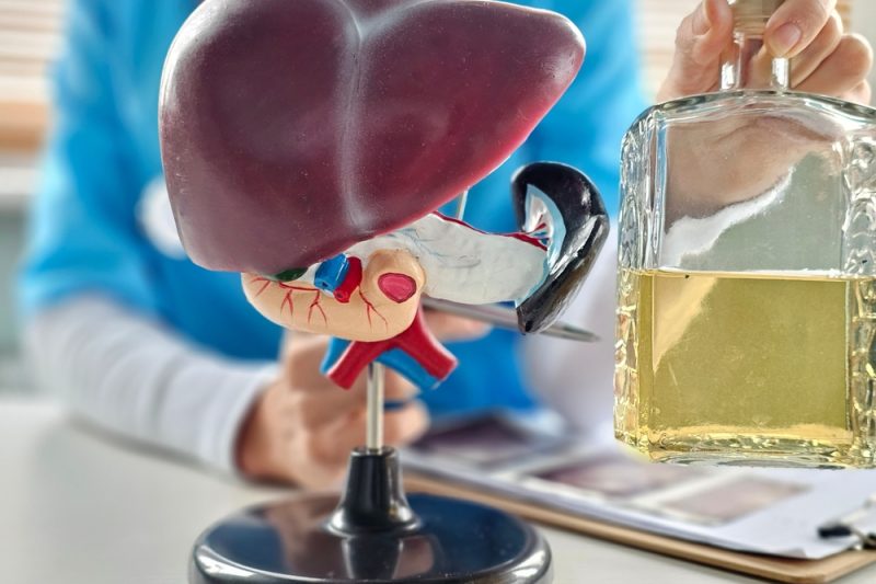 Model anatomic al ficatului alaturi de o sticla de alcool