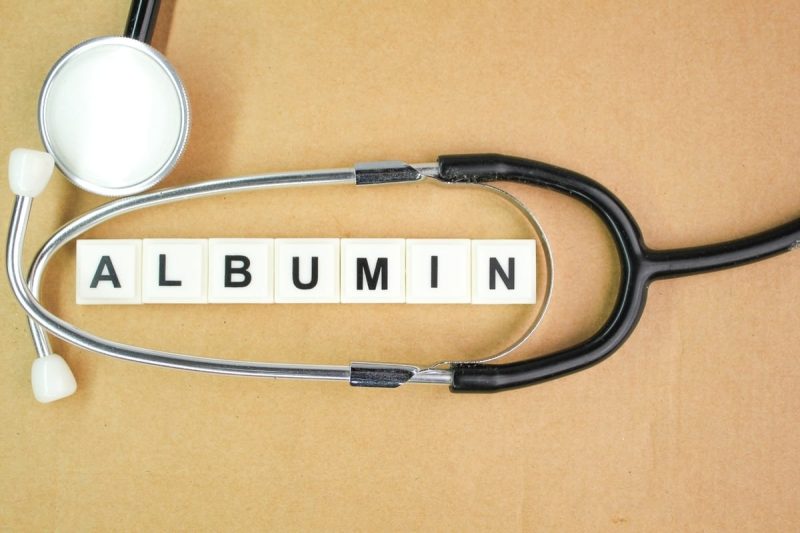 cuvântul albumină scris în centrul unui stetoscop