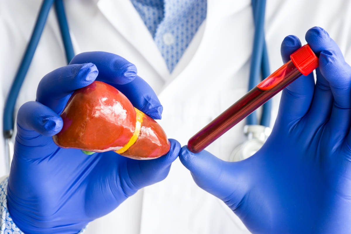 medic prezintă un model anatomic al ficatului