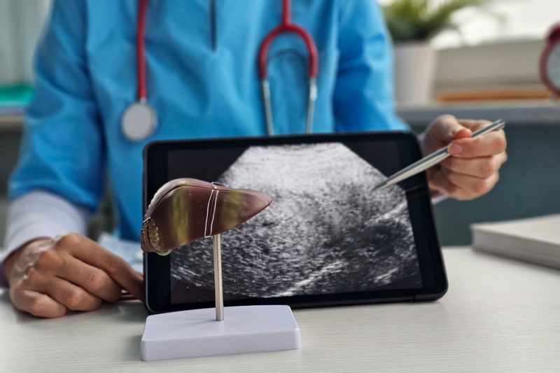 Imagine ecografică a ficatului