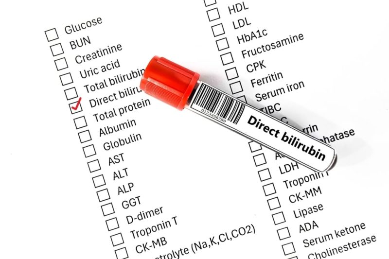 analiză de sânge, bilirubina directă