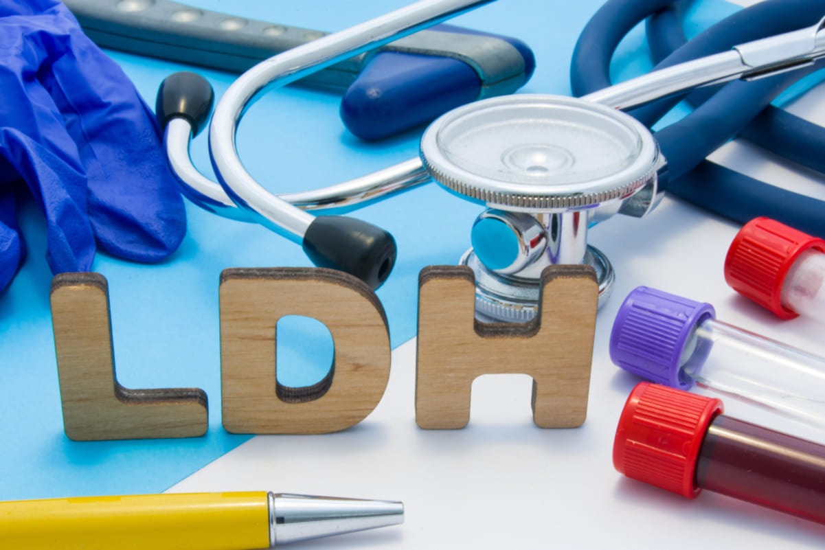 analiza de sânge LDH