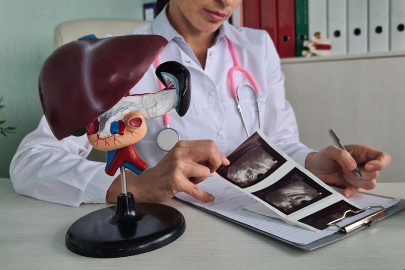 Medic analizând o ecografie hepatică