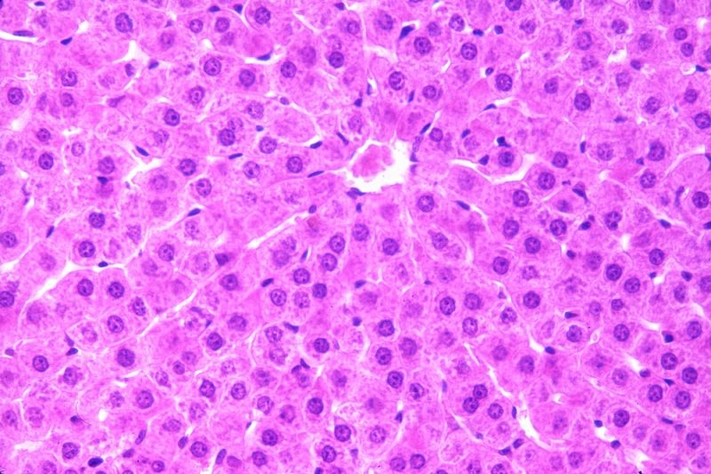 hepatocite văzute la microscop
