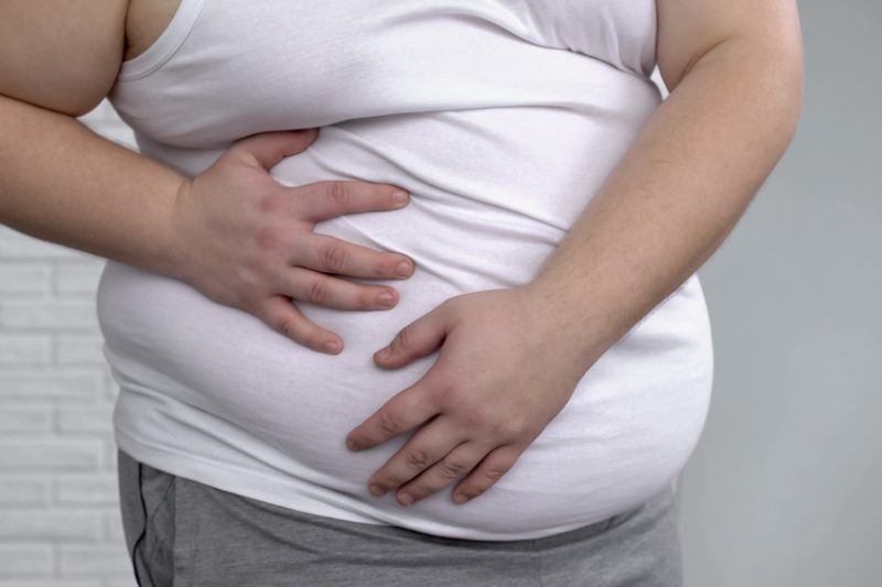 persoană diagnosticată cu obezitate