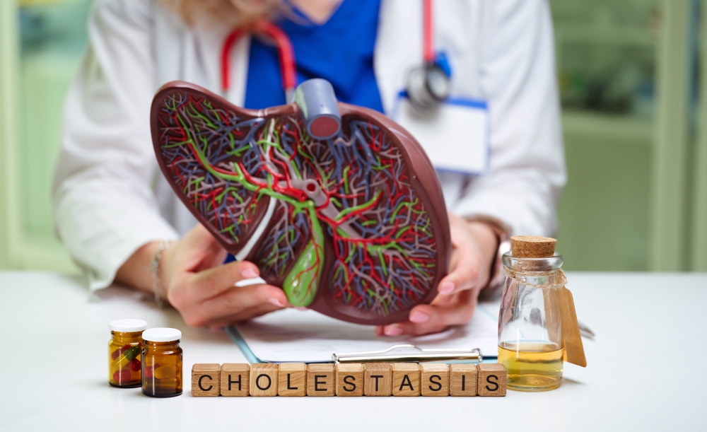 medic prezentând un model anatomic al ficatului, concept colestază