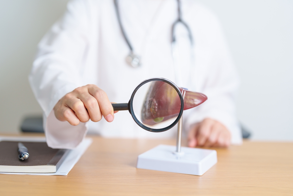 medic prezentand un model anatomic al ficatului