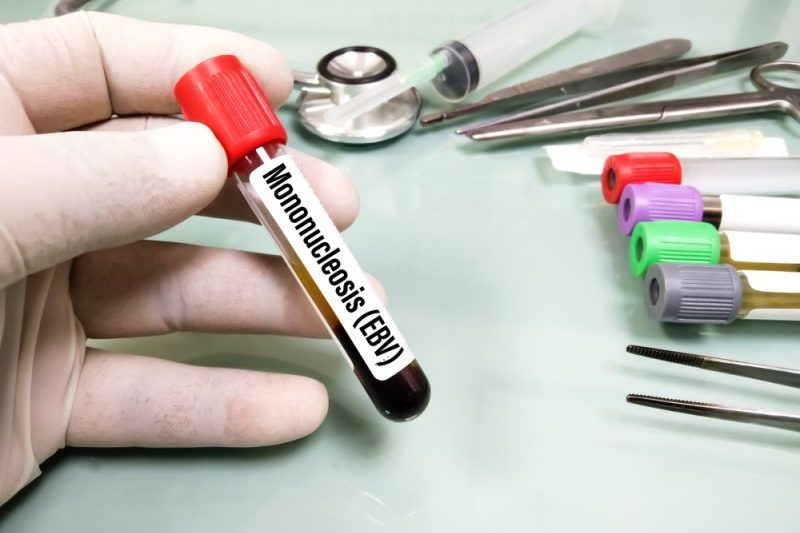 eprubeta de sange pentru testul de mononucleoza