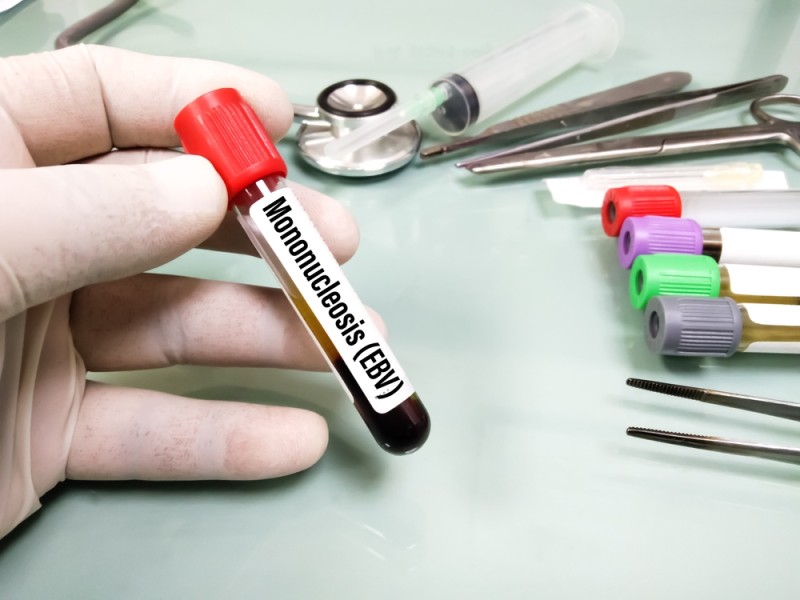 eprubeta de sange pentru testul de mononucleoza