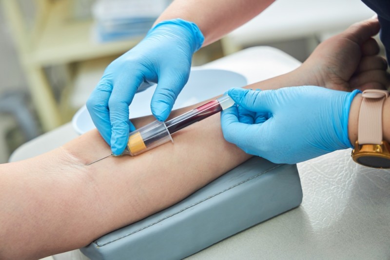 prelevarea sangelui pentru analize