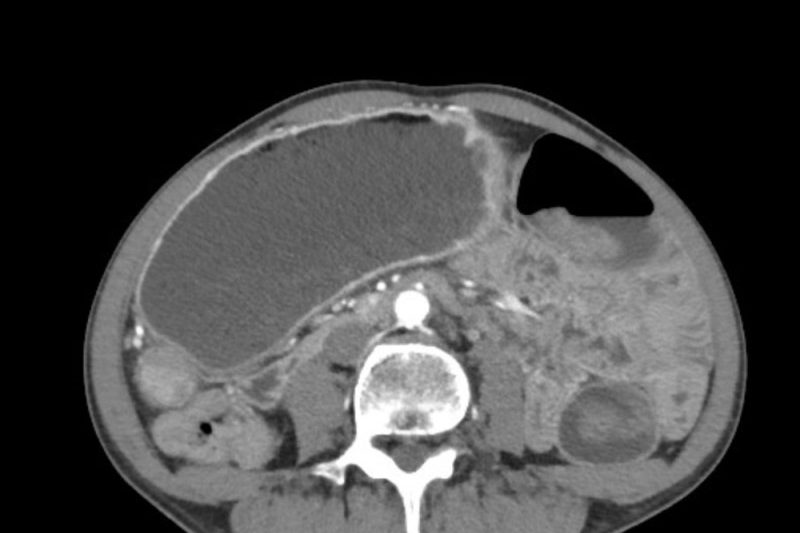 test imagistic al ficatului