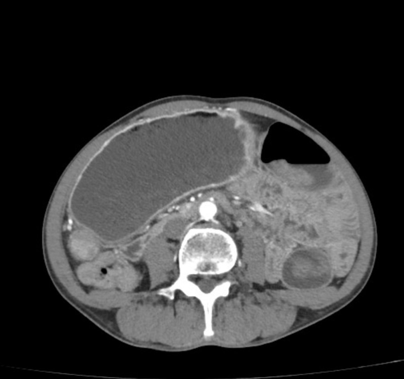 test imagistic al ficatului