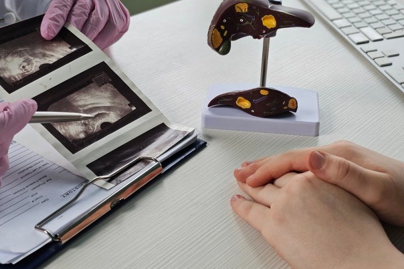 medic care discuta cu un pacient despre complicatiile bolilor de ficat