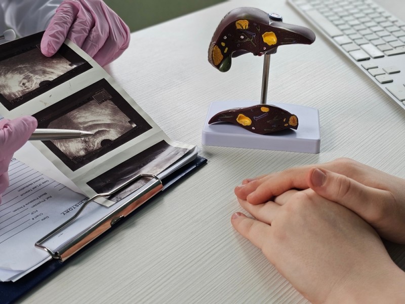 medic care discuta cu un pacient despre complicatiile bolilor de ficat